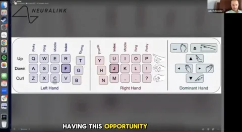 Neuralink Patient Hits 141 WPM With His Mind