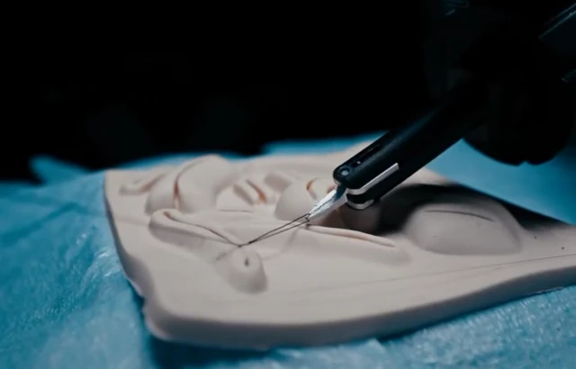 Aleph Surgery Raises $7.5M from a16z for AI-Powered Surgeon