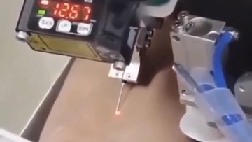 Robot draws blood with 94.3% success rate